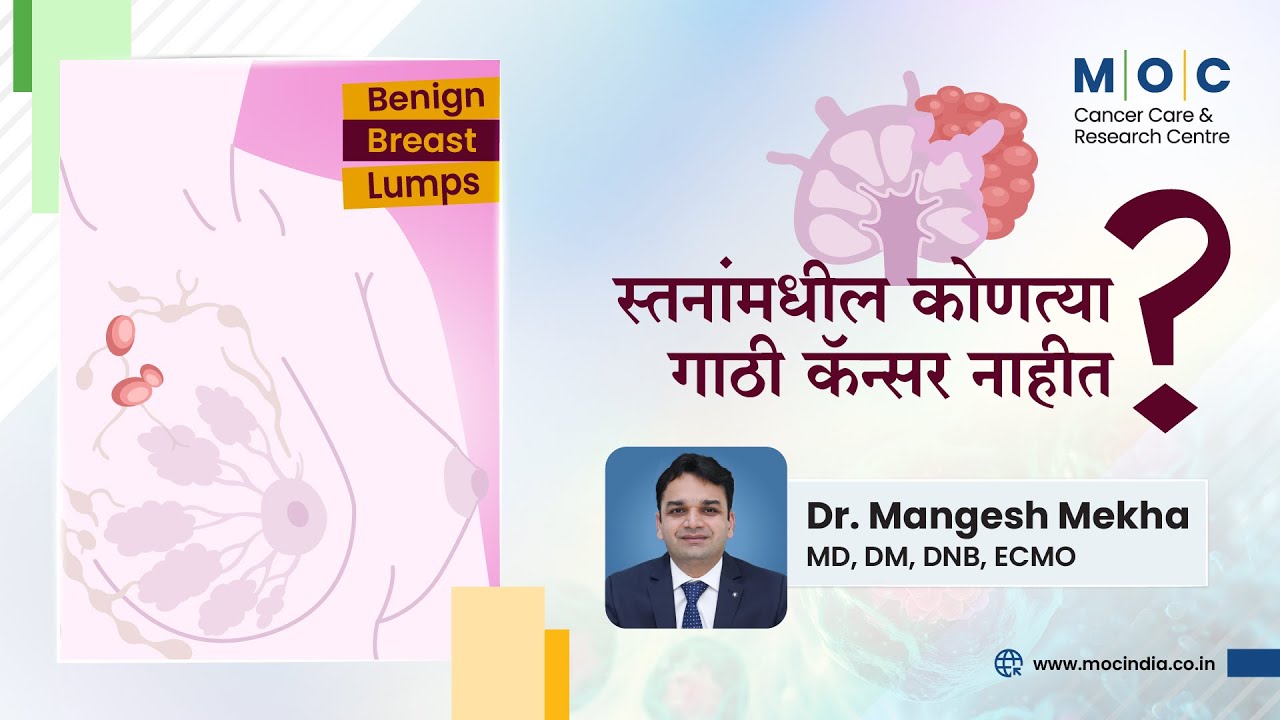 What are Non-Cancerous Breast Lumps? | Dr. Mangesh Mekha