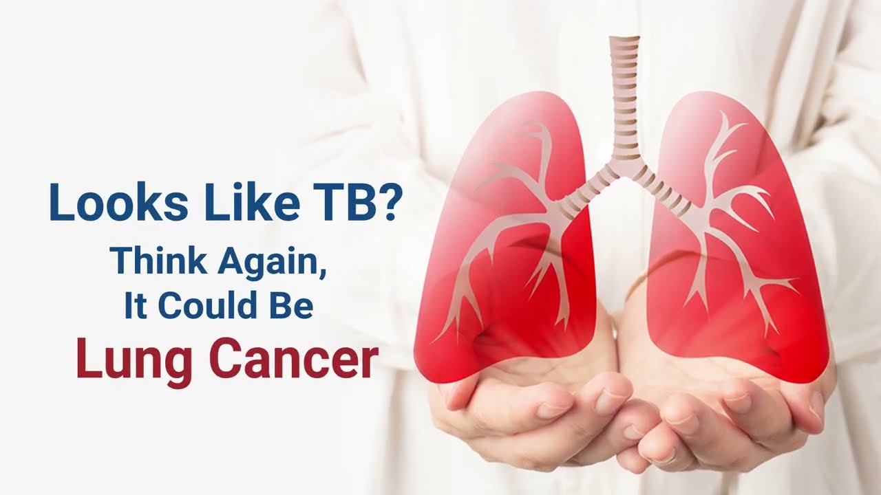 Tuberculosis or Lung Cancer? | Dr. Ritu Dave | M | O | C Shivaji Nagar